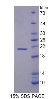 白介素1受体拮抗剂(IL1RA)重组蛋白