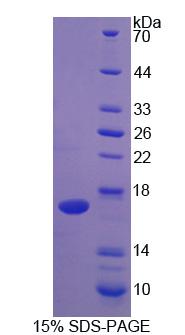 白介素2(IL2)重组蛋白