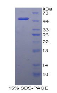 白介素21(IL21)重组蛋白