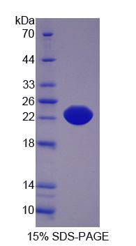白介素21受体(IL21R)重组蛋白