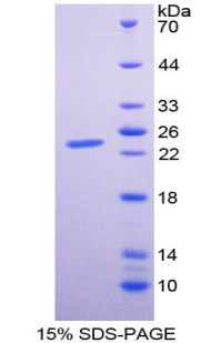 白介素29(IL29)重组蛋白