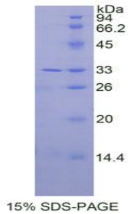 白介素31受体A(IL31RA)重组蛋白