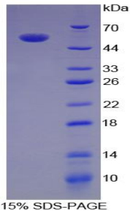 白介素35(IL35)重组蛋白