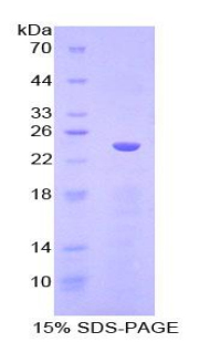 白细胞免疫球蛋白样受体亚家族B成员1(LILRB1)重组蛋白