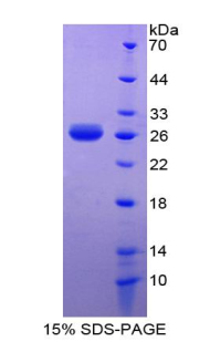 白细胞衍生趋化因子1(LECT1)重组蛋白