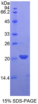 白细胞衍生趋化因子2(LECT2)重组蛋白