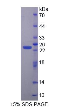 半胱氨酸甘氨酸丰富蛋白1(CSRP1)重组蛋白