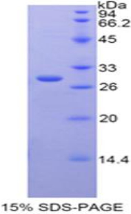 半乳糖-3-O-磺基转移酶1(GAL3ST1)重组蛋白