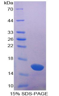 半乳糖凝集素1(GAL1)重组蛋白