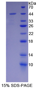 胞浆抗蛋白水解酶3(CAP3)重组蛋白