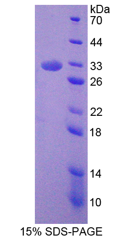 胞裂蛋白6(SEPT6)重组蛋白