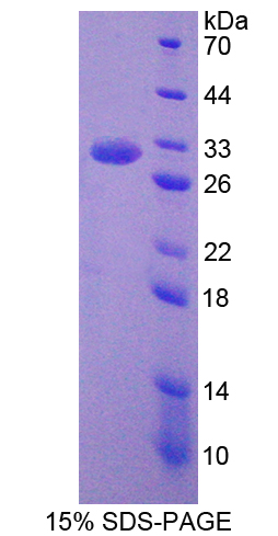 胞质分裂作用因子2(DOCK2)重组蛋白