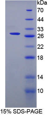 表面活性物质关联蛋白A2(SPA2)重组蛋白