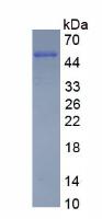 波形蛋白(VIM)重组蛋白
