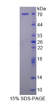 补体成分1q受体(C1qR1)重组蛋白