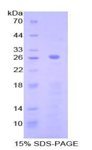 补体成分2(C2)重组蛋白