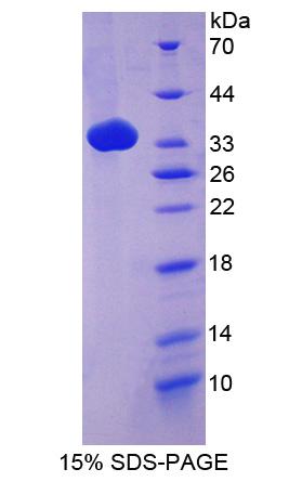 补体成分4(C4)重组蛋白