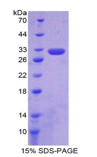 补体成分6(C6)重组蛋白