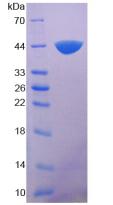 补体成分7(C7)重组蛋白