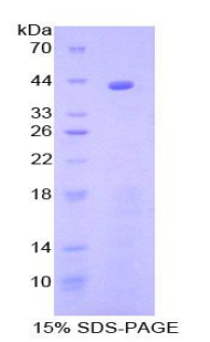 补体成分8β(C8b)重组蛋白