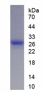 层粘连蛋白β1(LAMb1)重组蛋白