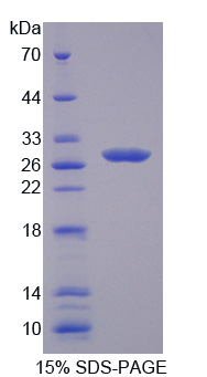 层粘连蛋白β4(LAMb4)重组蛋白