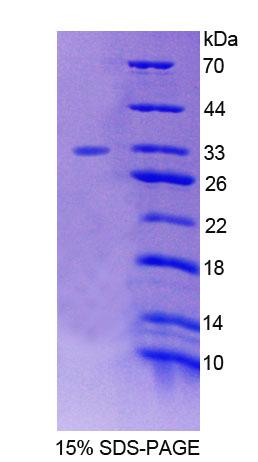 叉头框蛋白O3(FOXO3)重组蛋白