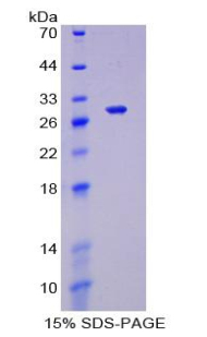 叉头框蛋白P1(FOXP1)重组蛋白