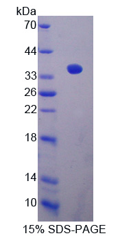 沉默调节蛋白4(SIRT4)重组蛋白