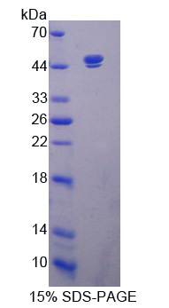 沉默调节蛋白7(SIRT7)重组蛋白