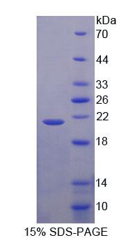 成神经细胞瘤抑制瘤变蛋白1(NBL1)重组蛋白
