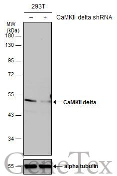 CaMKII delta antibody