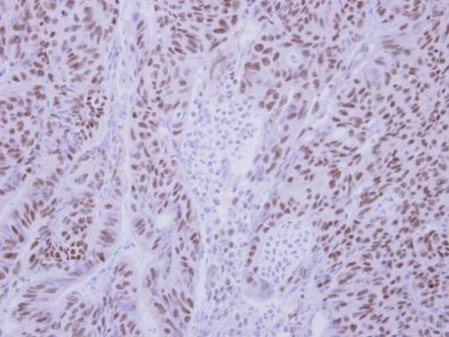 BS69 antibody