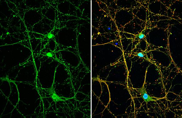 DOPA Decarboxylase antibody