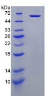 穿孔素1(PRF1)重组蛋白