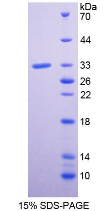 丛状蛋白A1(PLXNA1)重组蛋白