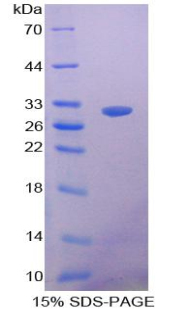 簇集蛋白(CLU)重组蛋白