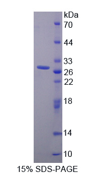 催乳素受体(PRLR)重组蛋白