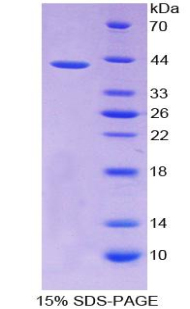 单核细胞趋化蛋白1(MCP1)重组蛋白