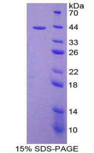 单核细胞趋化蛋白2(MCP2)重组蛋白