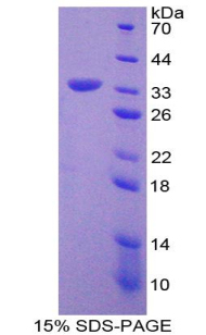 单核细胞趋化蛋白3(MCP3)重组蛋白