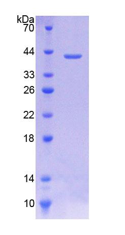 胆碱转运蛋白样蛋白1(CTL1)重组蛋白