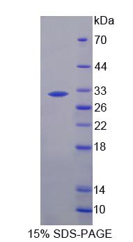 弹性蛋白酶2A(ELA2A)重组蛋白