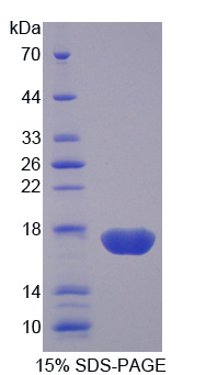 蛋白二硫化物异构酶A4(PDIA4)重组蛋白