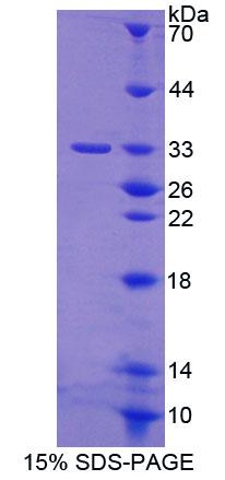 蛋白激酶D3(PKD3)重组蛋白