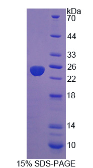蛋白酪氨酸磷酸酶ⅣA3(PTP4A3)重组蛋白