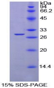 蛋白酪氨酸磷酸酶受体S(PTPRS)重组蛋白