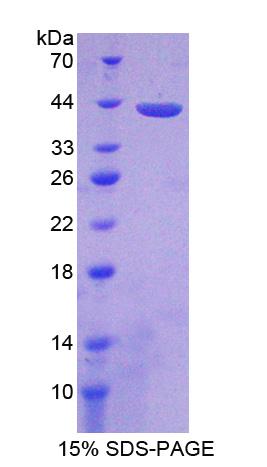 蛋白磷酸酶2A激活因子调节因子亚基4(PPP2R4)重组蛋白