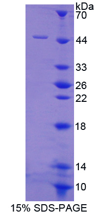 蛋白磷酸酶3调节因子亚基1(PPP3R1)重组蛋白
