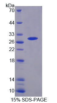 蛋白酶体亚基β6(PSMb6)重组蛋白